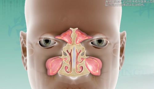 清鼻堂：你只知道鼻窦炎难受，但你知道鼻窦的作用吗？